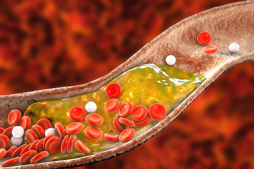 Study reveals high mortality lin...
