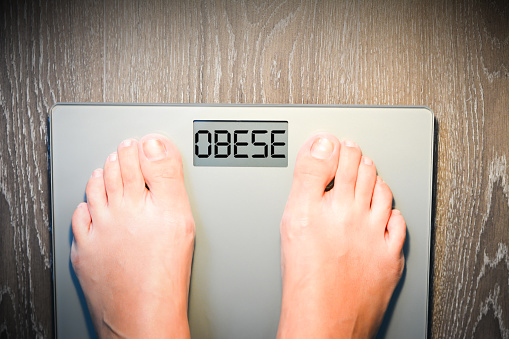 Research finds severe obesity li...