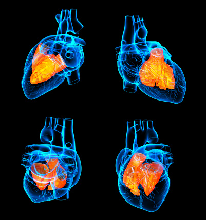 Five types of heart failure: Acu...