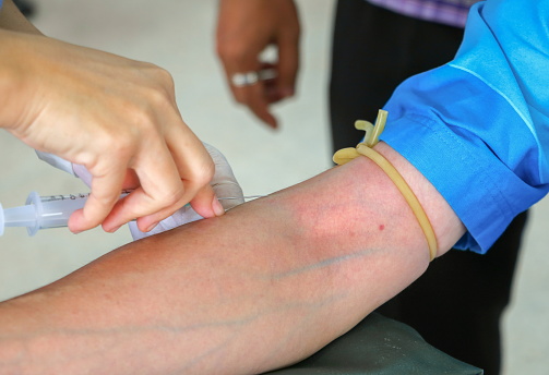 The real reason your veins appea...