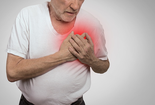Multifocal atrial tachycardia: C...