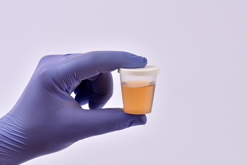 What to do if you notice blood i...