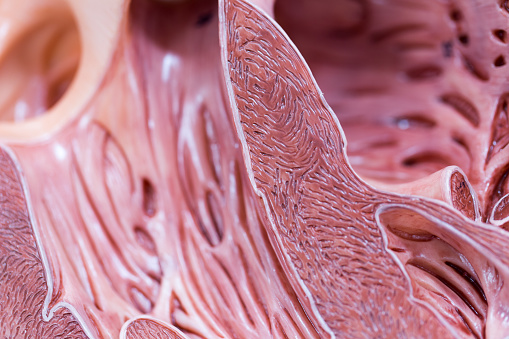 Carotid Artery Disease: Causes, ...