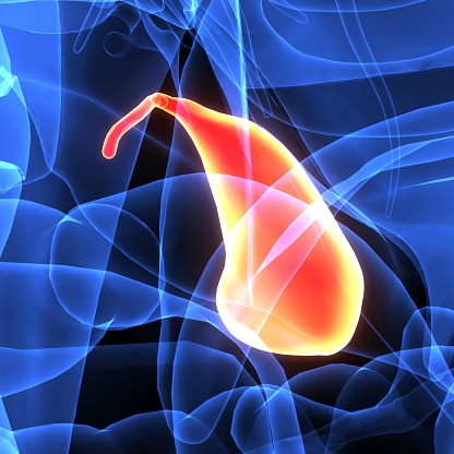 Biliary Colic: Causes, Symptoms,...