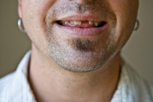 Tooth Loss? You May Be at a Risk...