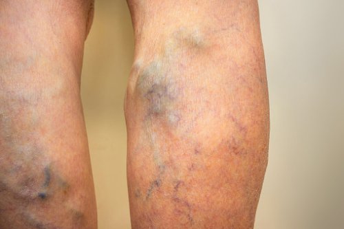 The Serious Condition Unsightly ...