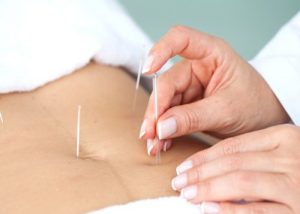 acupuncture for digestion