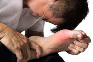 Gout associated with increased risk