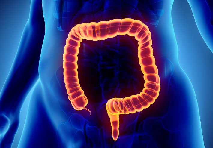 Microscopic Colitis: Types, Caus...