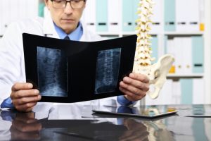 osteoporosis screening