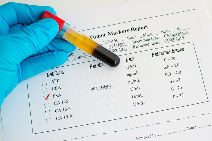 The Health Test You May Not Need