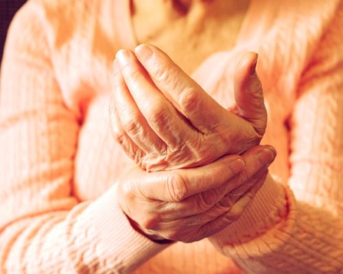 Physical activity in rheumatoid arthritis patients