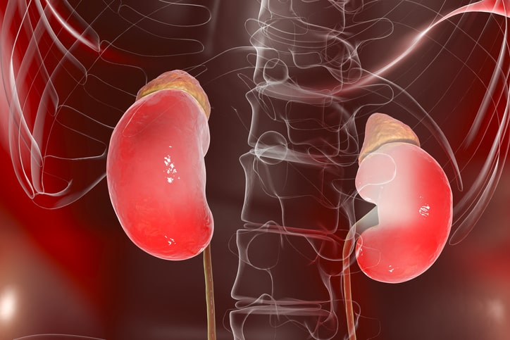 Your Risk of Kidney Disease Is H...