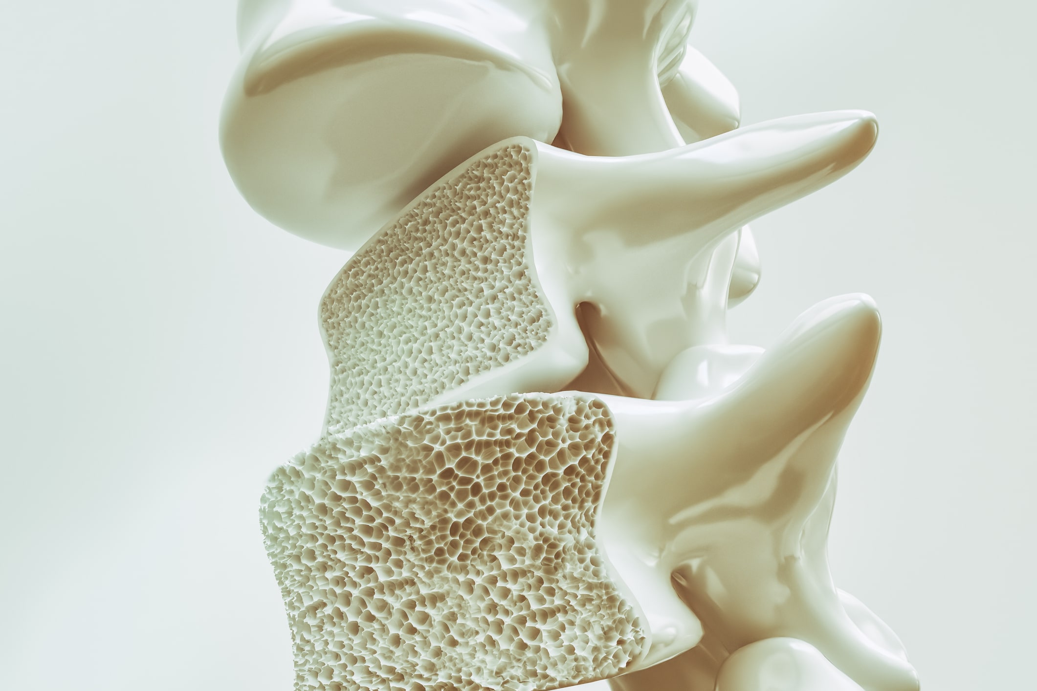 Radical New Treatment for Osteop...