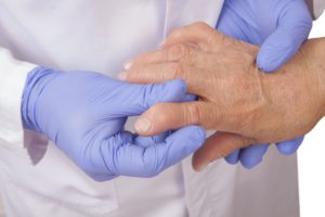 rheumatoid arthritis, frailty, osteoporotic fracture
