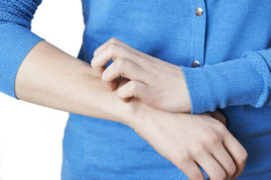Close Up Of Woman Scratching Armwomanw