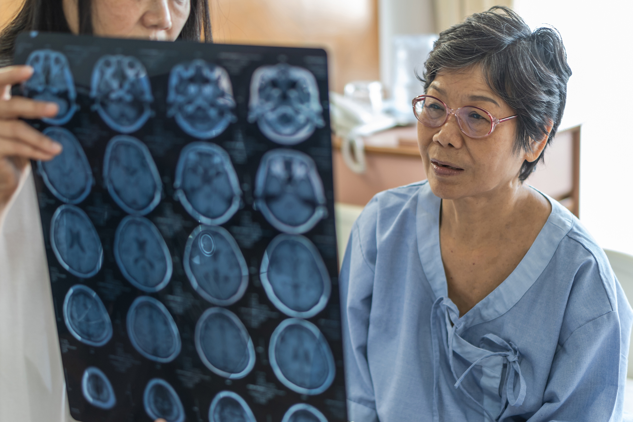 New Study Identifies Alzheimer&#...