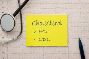 Good HDL and bad LDL cholesterol text on note with stethoscope and heartbeat rate, cardiogram and EKG concept.