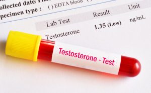 Abnormal low testosterone hormone test result with blood sample tube
