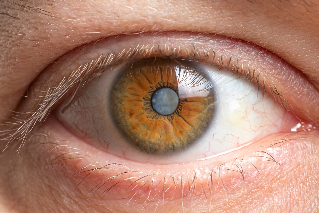 Retinal Damage May Provide Warni...