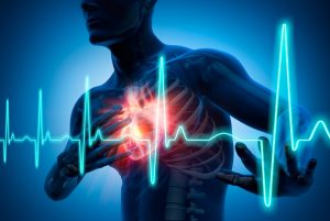 3D Rendering - Schmerz im Brustkorb - Herzanfall - Medizinische Illustration