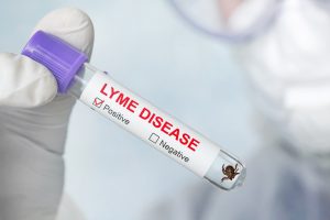 dangerous carrier of Lyme disease in glass vial in a doctor's office. Lyme disease label on a test tube in the hands of a laboratory assistant. Diagnosing patients after a tick bite.