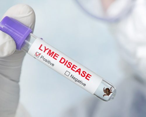 dangerous carrier of Lyme disease in glass vial in a doctor's office. Lyme disease label on a test tube in the hands of a laboratory assistant. Diagnosing patients after a tick bite.