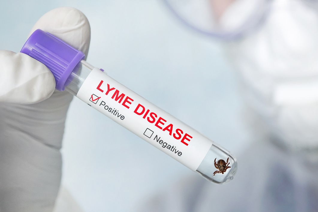 Protect Yourself from Lyme Disease