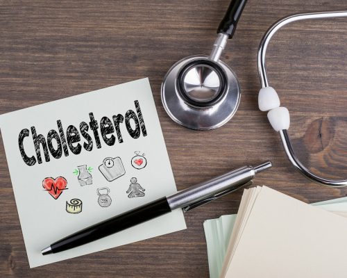 Cholesterol, Workplace of a doctor. Stethoscope on wooden desk background.