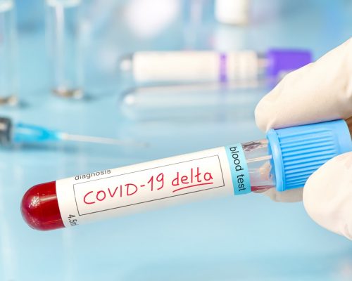 Doctor with a positive blood sample for the new variant detected of the coronavirus strain called covid DELTA. Research of new strains and mutations of the Covid 19 coronavirus in the laboratory