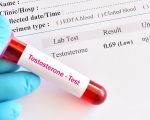 Abnormal low testosterone hormone test result