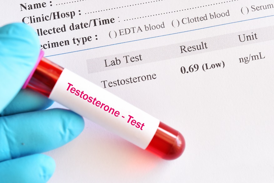 Testosterone: What It Does and D...