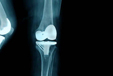 How You Can Give Yourself the Be...