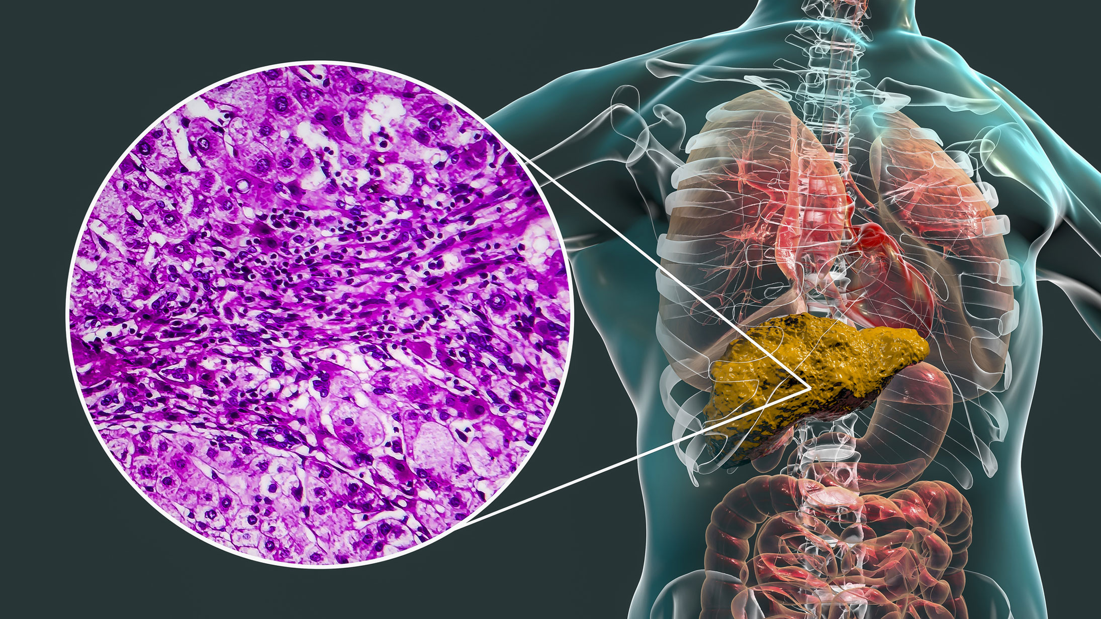 Will your liver repair itself after years of drinking 