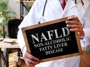 Enfermedad del hígado graso no alcohólico NAFLD el médico sostiene el cartel.