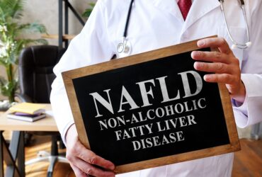 Non-Alcoholic Fatty Liver Diseas...
