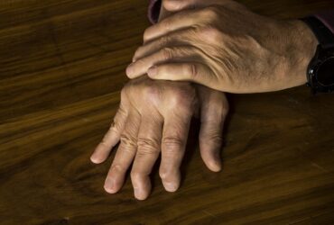 Figuring Out Arthritis in Your H...