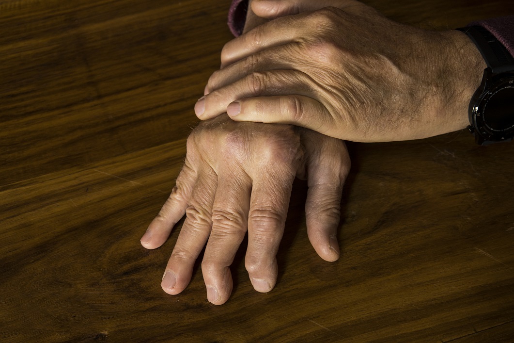 Managing arthritis during the ho...