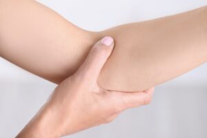 Close-up of a woman pressing the fold of her arm. Elbow pain, joint disease, skin care. Muscle weakness, atrophy